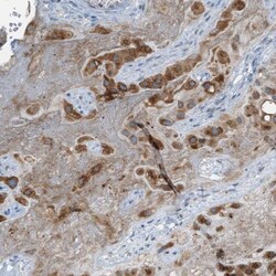 CSGLCAT Antibody, Novus Biologicals 25 &mu;L; Unlabeled:Antibodies, Polyclonal